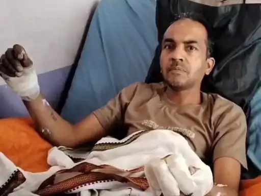 देवास जिले में बड़ी वारदात, पेप्सी उधार न देने पर किराना दुकान में लगा दी आग, आरोपियों ने दुकानदार पर भी किया हमला, गंभीर रूप से झुलसे