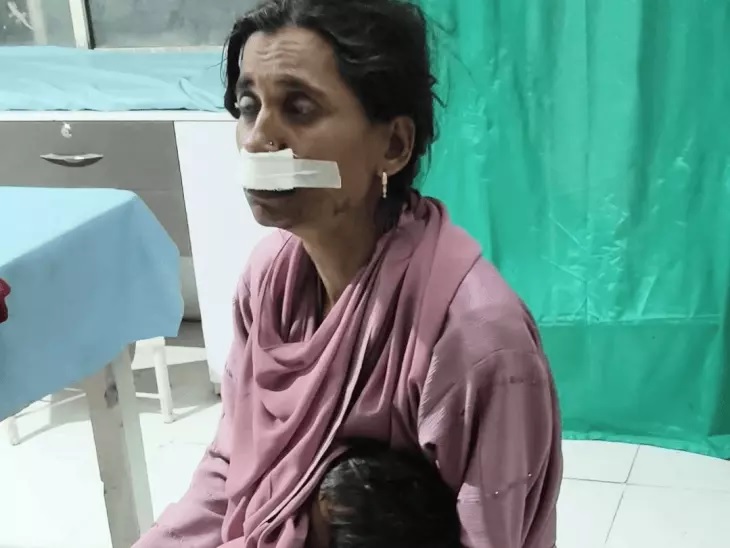 देवास: पति ने पत्नी का होंठ काटा, तीन साल पहले हुई थी लव मैरिज